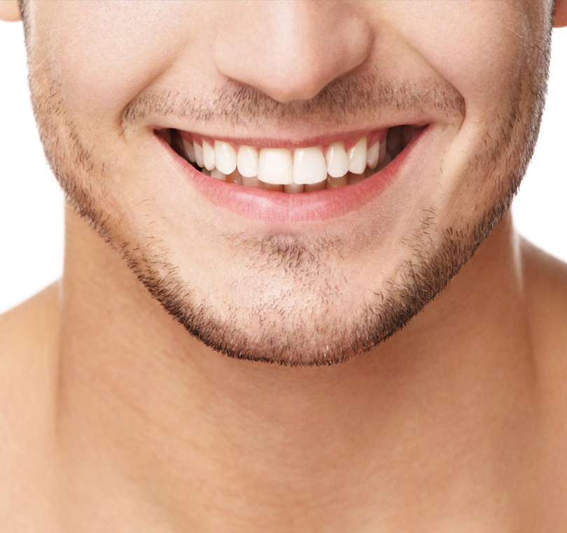 Faccette dentali Seregno