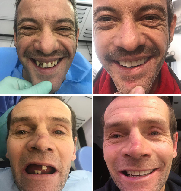 Casi clinici implantologia