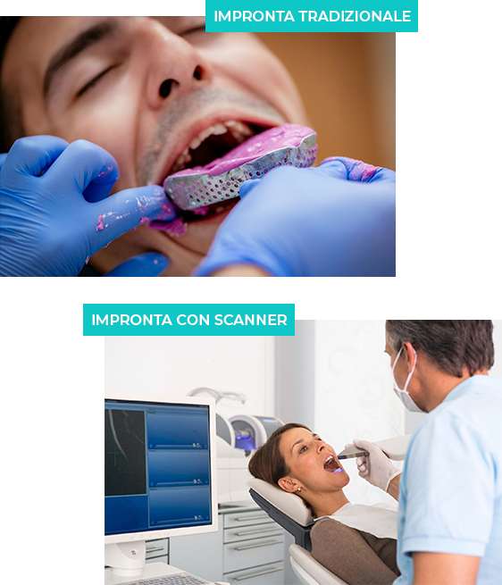 Scanner intraorale Seregno