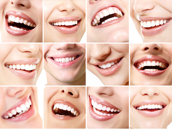 Apparecchio invisibile Seregno